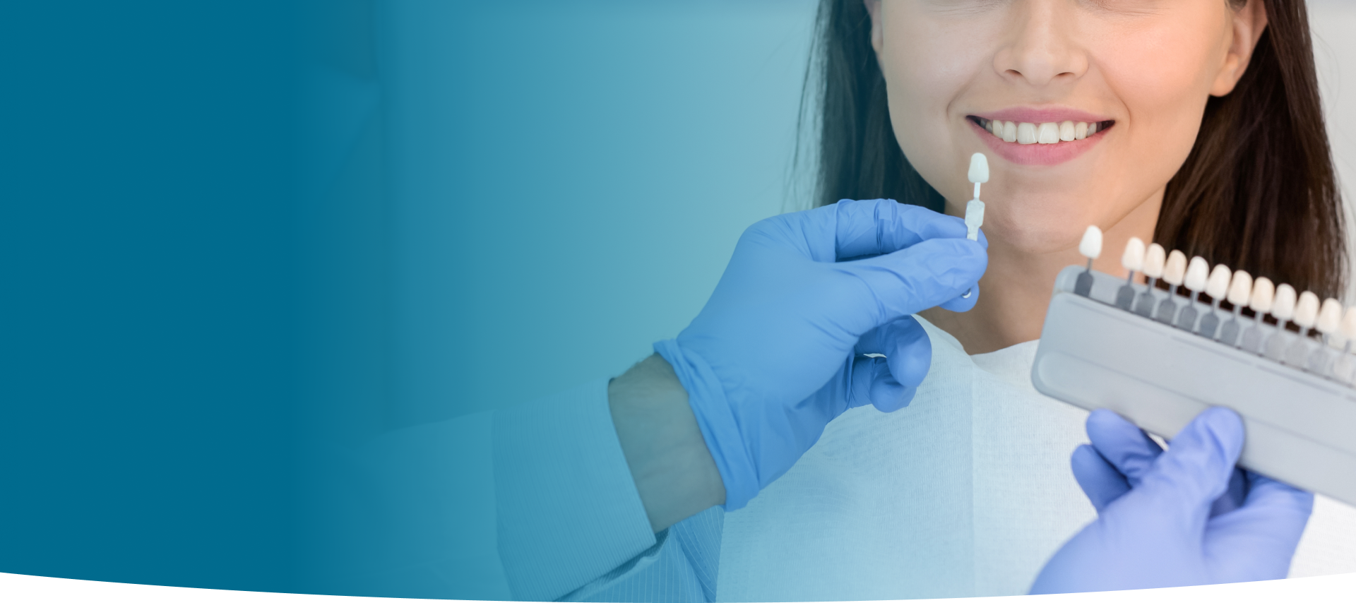Porcelain Laminate Veneers at World Dental Specialities