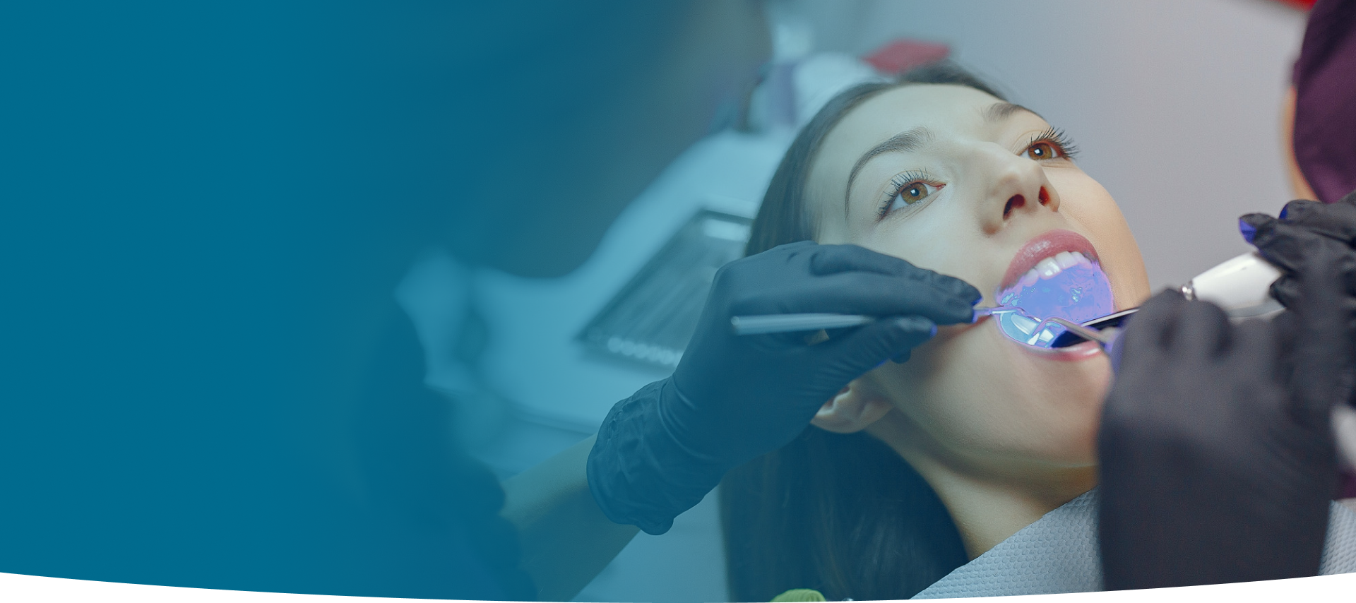 Dental Fillings at World Dental Specialities