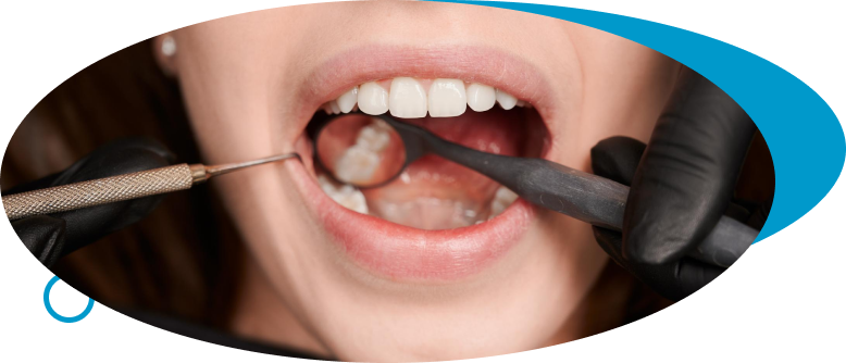 Dental Fillings at World Dental Specialities