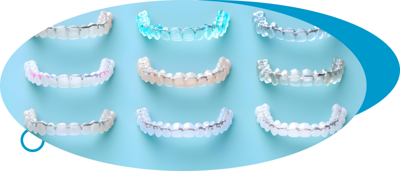 Dental Invisalign at World Dental Specialities