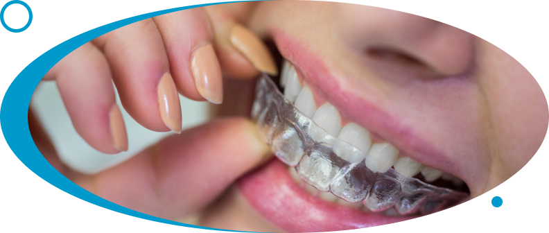 Dental Invisalign at World Dental Specialities