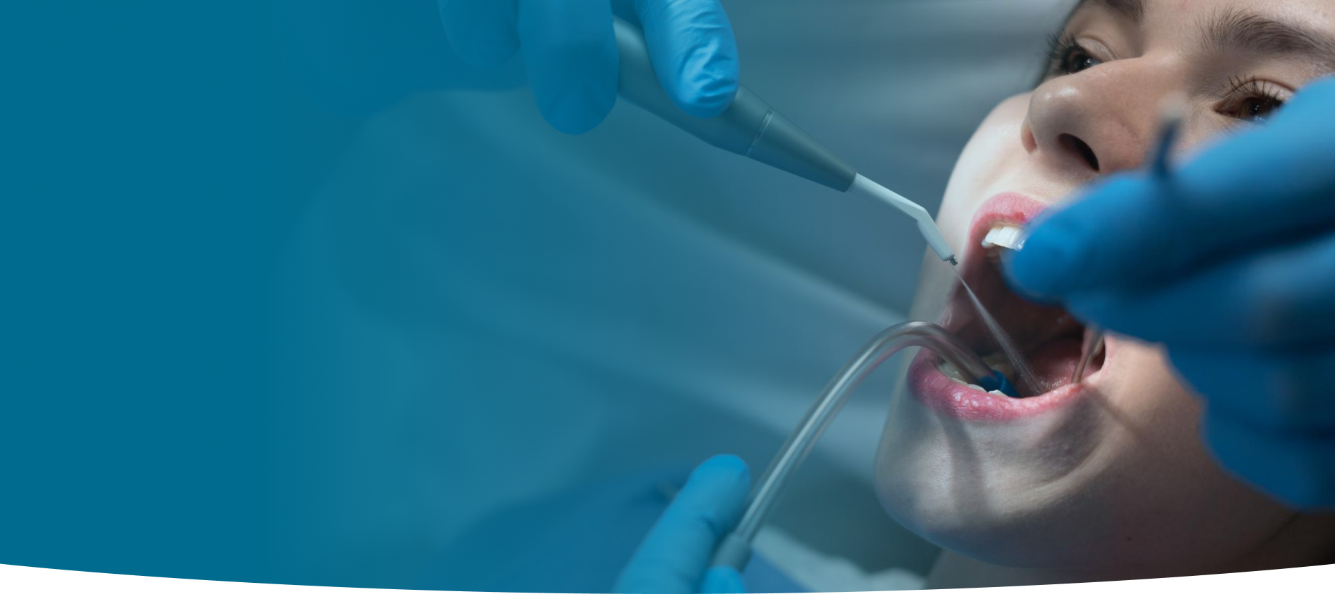 Endodontics Root Canal Therapy at World Dental Specialities