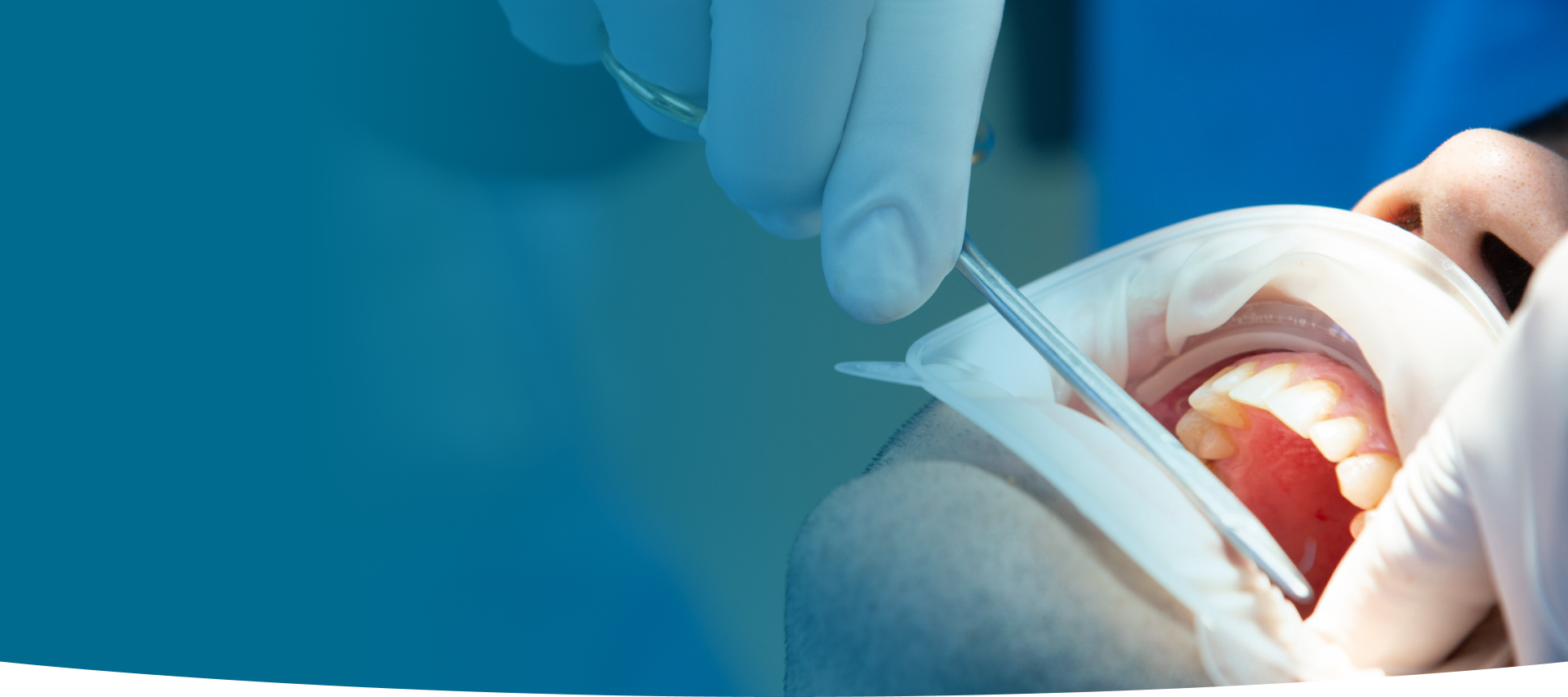 Oral Surgical Procedures at World Dental Specialities