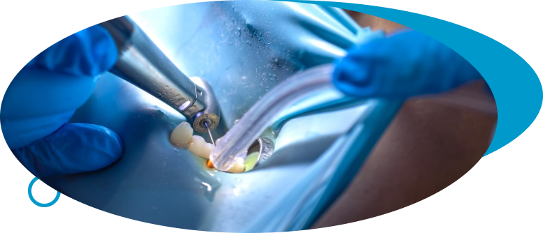 Oral Surgical Procedures at World Dental Specialities