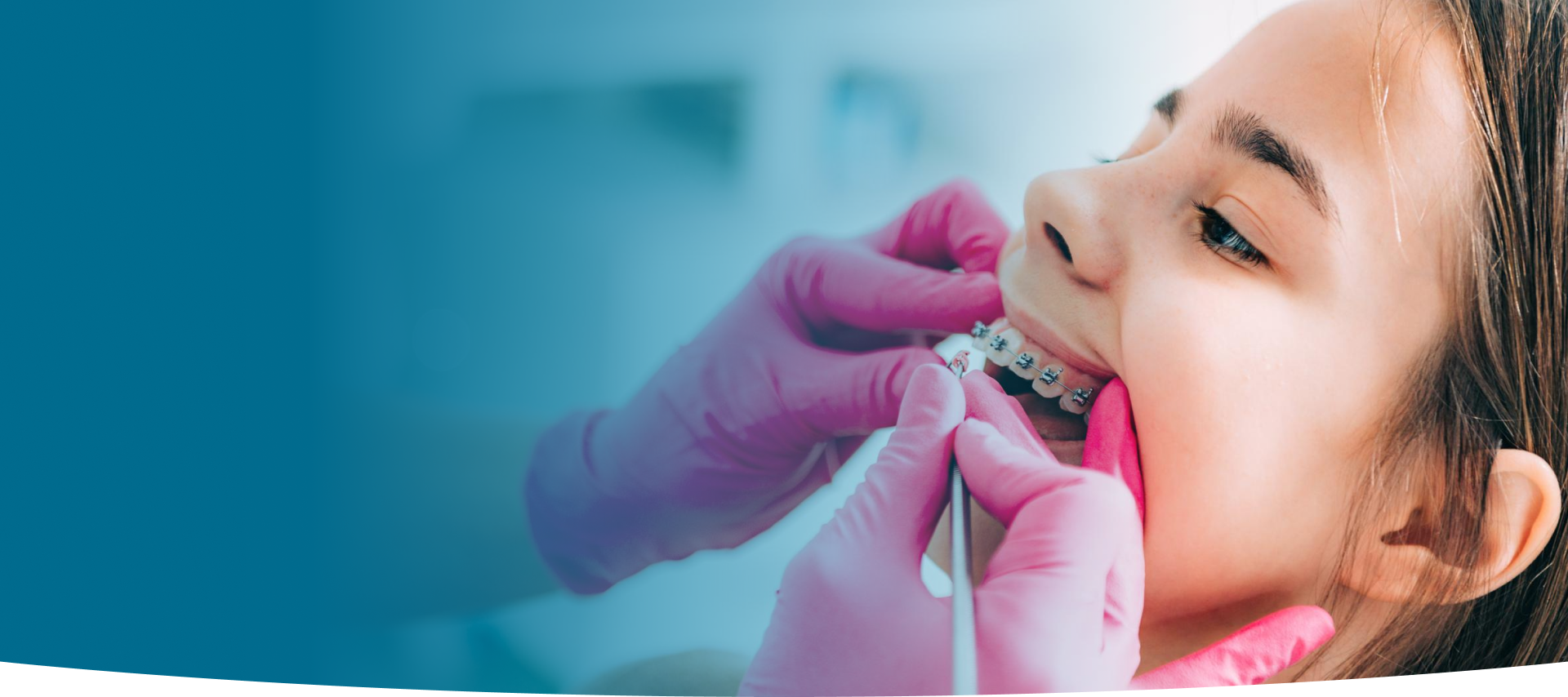 Orthodontic Treatment at World Dental Specialities