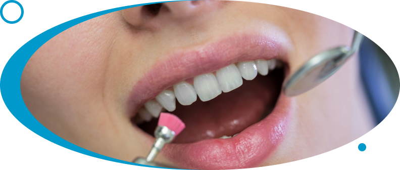 Smile Makeovers Mumbai at World Dental Specialities