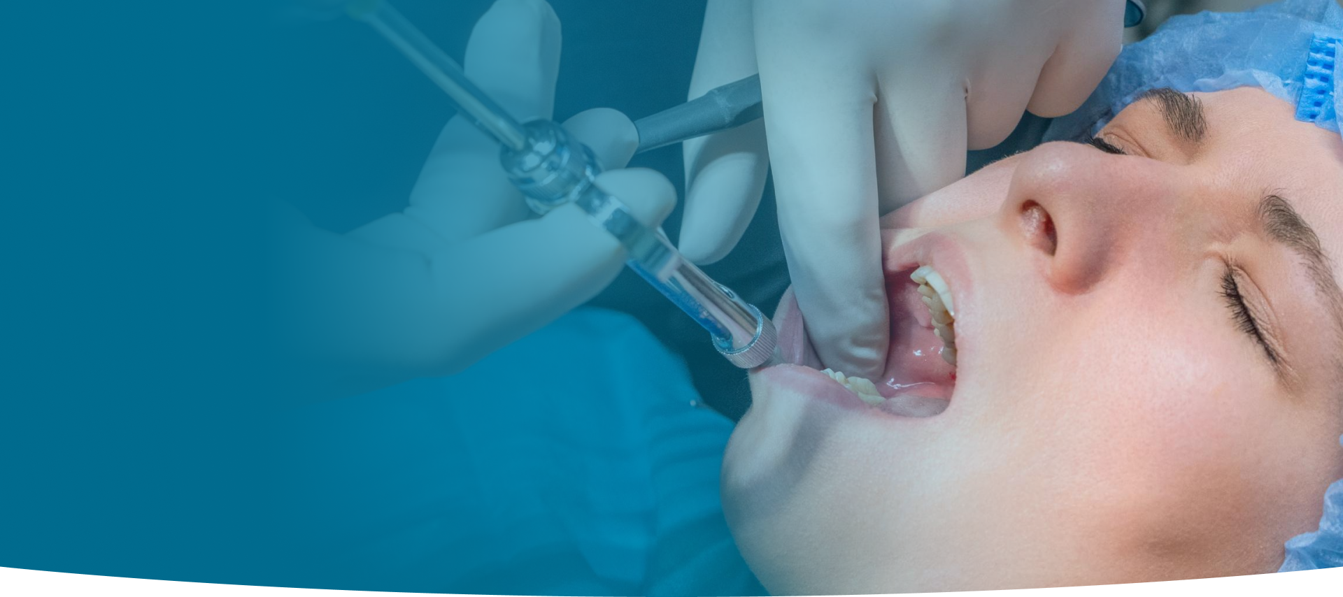 Wisdom Tooth Extraction at World Dental Specialities