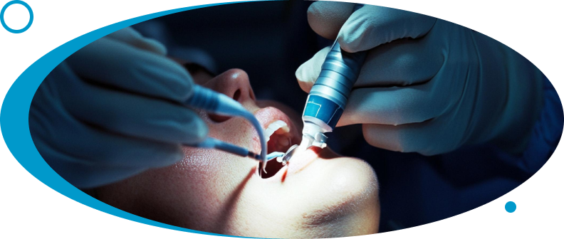 Wisdom Tooth Extraction at World Dental Specialities