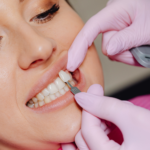 Porcelain Veneer Dentist Mumbai